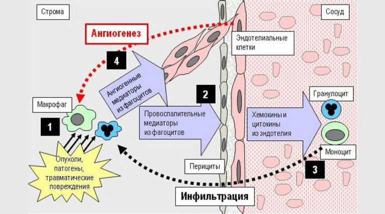 Опухолевый ангиогенез